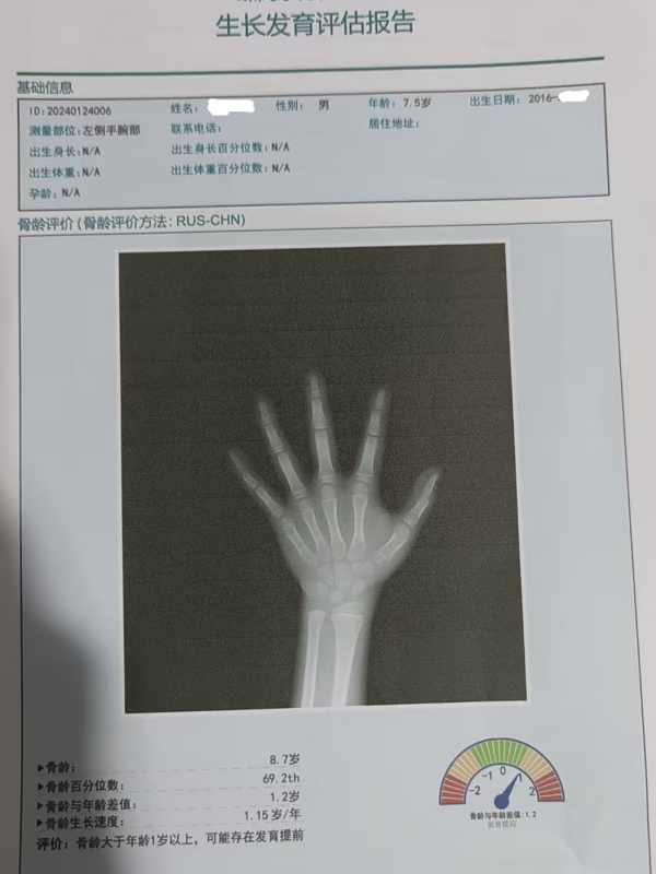 骨齡和身高有什么關(guān)系？每個(gè)孩子都有必要檢測嗎？